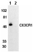 All lanes : Anti-CX3CR1 antibody (ab8020) at 1/500 dilutionLane 1 : THP-1 cell lysate with absence of blocking peptideLane 2 : THP-1 cell lysate with presence of blocking peptide