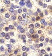 ab8020 at 10µg/ml staining CX3CR1 in human spleen cells by IHC