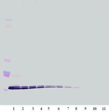 Anti-CXCL16 antibody (ab175341) at 0.2 µg/mlPerformed under non-reducing conditions.