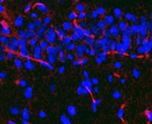 ab14936 staining CXCR1 in rat whole hippocampus tissue by Immunohistochemistry (Frozen sections). After fixation in 4% PFA in PBS (pH 7.4), brains were cryoprotected in 30% sucrose in PBS at +4°C, frozen, and thereafter kept at -80°C until used. For the immunostaining, brains were cryosectioned in 30 µm slices, collected in PBS (pH 7.4), and processed in a free-floating system. Slices were first incubated in the blocking solution (BS) containing 2% bovine serum albumin, 2% goat serum, and 0.1% Triton X-100 in PBS (pH 7.4) for 1 hour at room temperature, and thereafter with the primary antibody for 24–48 hours at +4°C in BS at a 1/1000 dilution. After washing in PBS, slices were incubated with an Alexa 568 secondary antibody at a 1/2000 dilution.