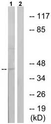 All lanes : Anti-CXCR4 (phospho S339) antibody (ab74012) at 1/500 dilutionLane 1 : Extracts from HUVEC cells treated with etoposide (25uM, 24hours)Lane 2 : Extracts from HUVEC cells treated with etoposide (25uM, 24hours) with the immunising phosphopeptide at 5 µgLysates/proteins at 5 µg per lane.