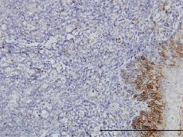 CXCR4 antibody (ab58176) used in immunohistochemistry at 3ug/ml on formalin fixed and paraffin embedded human tonsil.