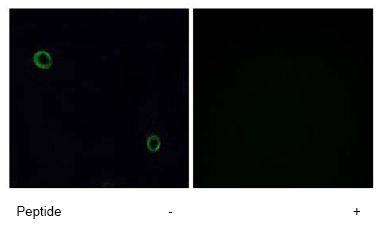 Immunofluorescence analysis of A549 cells using ab77909 at a 1/500 dilution.Left image un-treated.Right image treated with immunizing peptide.