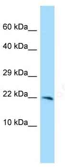 Anti-CXorf40A antibody - C-terminal (ab135436) at 1 µg/ml + MCF7 cell lysate at 10 µg