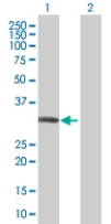 All lanes : Anti-CYB5R3 antibody (ab67526) at 1/500 dilutionLane 1 : CYB5R3 transfected lysateLane 2 : Non-transfected lysateLysates/proteins at 25 µg per lane.SecondaryGoat anti-mouse IgG (H&L)-HRP conjugate at 1/2500 dilution