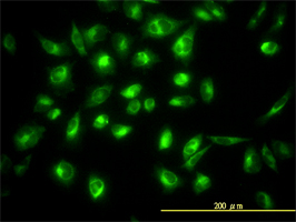 COG7 antibody (ab57936) used in immunofluorescence at 10ug/ml on HeLa cells.