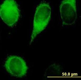 ab67526, at 10µg/ml, staining CYB5R3 in Hela cell by Immunofluorescence.