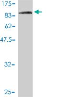 Western blot against tagged recombinant protein immunogen using ab57936 COG7 antibody at 1ug/ml.