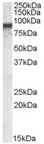 Anti-COG7 antibody (ab77539) at 0.03 µg/ml + MOLT4 lysate in RIPA buffer at 35 µgObserved band size : 85 kDa (why is the actual band size different from the predicted?)