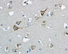 Immunohistochemical analysis of paraffin-embedded Human brain tissue labeling COG7 with ab168362 at 1/100 dilution.