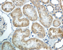 Immunohistochemical analysis of paraffin-embedded Human kidney tissue labeling COG7 with ab168362 at 1/100 dilution.