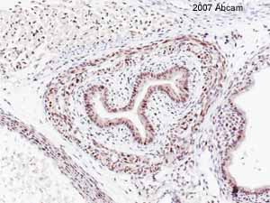 ab7956 at 1/150 staining developing mouse embryo tissue sections (5 microns) by IHC-P. The tissue was formaldehyde fixed and and heat mediated antigen retrieval step in citric acid buffer was performed. The tissue was blocked in BSA and incubated with the antibody for 2 hours. A biotinylated goat antibody was used as the secondary. The image shows T/S of developing oesophagus, trachea, skeletal muscle and blood vessel wall.See Abreview