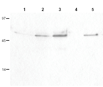 All lanes : Anti-Cyclin B1 (phospho S126) antibody (ab3488) at 1/100 dilutionLane 1 : HeLa whole cell lysateLane 2 : H23 whole cell lysateLane 3 : Hepatocarcinoma (Hep3b) cell lysateLane 4 : Glioblastoma (T98G) cell lysate Lane 5 : B cell lymphoblast (Daudi) cell lysateLysates/proteins at 50 µg per lane.SecondaryHRP-conjugated Goat anti-Rabbit IgG at 1/5000 dilutiondeveloped using the ECL techniquePerformed under reducing conditions.