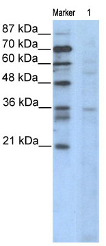 Anti-Cyclin B3 antibody (ab66384) at 2.5 µg/ml + Jurkat cell lysate at 10 µgSecondaryHRP conjugated anti-Rabbit IgG at 1/50000 dilution