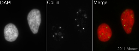 ab87913(1/2000) staining Coilin in assynchronous HeLa cells (green). Cells were fixed in methanol (this image) or paraformaldehyde (see abreview image), permeabilized with 0.5% Triton X100 and counterstained with DAPI in order to highlight the nucleus (red). for further experimental details please refer to Abreview.See Abreview