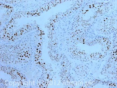 IHC image of Coilin staining in Human normal testis formalin fixed paraffin embedded tissue section, performed on a Leica BondTM system using the standard protocol F. The section was pre-treated using heat mediated antigen retrieval with sodium citrate buffer (pH6, epitope retrieval solution 1) for 20 mins. The section was then incubated with ab87913, 5µg/ml, for 15 mins at room temperature and detected using an HRP conjugated compact polymer system. DAB was used as the chromogen. The section was then counterstained with haematoxylin and mounted with DPX.For other IHC staining systems (automated and non-automated) customers should optimize variable parameters such as antigen retrieval conditions, primary antibody concentration and antibody incubation times.