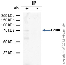 Coilin was immunoprecipitated using 0.5mg HepG2 whole cell extract, 5µg of Mouse monoclonal to Coilin and 50µl of protein G magnetic beads (+). No antibody was added to the control (-). The antibody was incubated under agitation with Protein G beads for 10min, HepG2 whole cell extract lysate diluted in RIPA buffer was added to each sample and incubated for a further 10min under agitation.Proteins were eluted by addition of 40µl SDS loading buffer and incubated for 10min at 70oC; 10µl of each sample was separated on a SDS PAGE gel, transferred to a nitrocellulose membrane, blocked with 5% BSA and probed with ab87913.Secondary: Goat polyclonal to mouse IgG light chain specific (HRP) at 1/5000 dilution.Band: 75kDa: Coilin