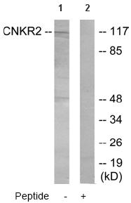 All lanes : Anti-CNKR2 antibody (ab64844) at 1/500 dilutionLane 1 : Extracts from Jurkat cellsLane 2 : Extracts from Jurkat cells with blocking peptide at 5 µgLysates/proteins at 5 µg per lane.