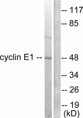 All lanes : Anti-Cyclin E1 antibody (ab52239) at 1/300 dilutionLane 1 : K562 cell extract; without peptideLane 2 : K562 cell extract; with peptide
