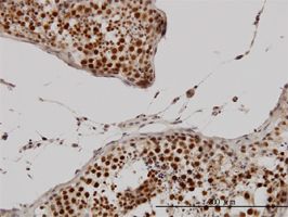 Cyclin H antibody (ab54903) used in immunohistochemistry at 3ug/ml on formalin fixed and paraffin embedded human testis.
