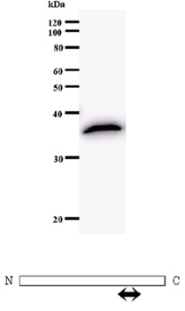 Anti-Cyclin T2 antibody [2128C1a] (ab50979) + recombinant protein fragment used as immunogen. Diagram underneath blot depicts region of Cyclin T2 protein that was employed as immunogen (arrow).