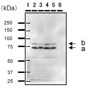 All lanes : Anti-Cyclin T2 antibody [2128C1a] (ab50979)Lane 1 : Molecular Weight MarkerLane 2 : 50µg Hela Whole cell lysateLane 3 : 50µg HT-1080 Whole cell lysateLane 4 : 50 µg HEK293 Whole cell lysateLane 5 : 50µg A2058 Whole cell lysateLane 6 : 50µg HIH3T3 Whole cell LysateSecondaryLanes 2 - 6 : Mouse IgG Antibody 1/2500developed using the ECL techniquePerformed under reducing conditions.