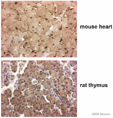 ab41684 staining mouse heart and rat thymus tissue sections by IHC-P.  Sections were formaldehyde fixed and subjected to heat mediated antigen retrieval in citrate buffer (pH 6) prior to blocking in sequential peroxidase and protein block (prediluted) for 20 minutes at 20°C.  The primay antibody was diluted 1/100 and incubated with the samples for 45 minutes at 20°C.  A HRP-conjugated goat anti-rabbit anitbody was used as the secondary.See Abreview
