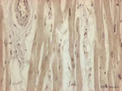 ab42408 staining Cyclophilin A in human heart tissue section by Immunohistochemistry (Formalin/PFA-fixed paraffin-embedded sections). Tissue underwent formaldehyde fixation before heat mediated antigen retrieval and then blocked (5 minutes of peroxidase block and 10 minutes of protein block) for 15 minutes at 20°C. The primary antibody was used undiluted and incubated with sample for 45 minutes at 20°C. A HRP conjugated goat polyclonal to rabbit IgG was used, undiluted as secondary. See Abreview