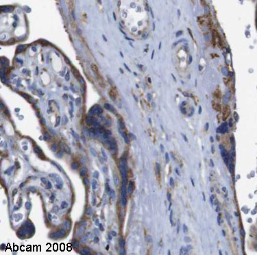 Image courtesy of Human Protein Atlas ab16045 staining in human placenta, showing staining of the cytrotrophoblasts. Paraffin embedded placental tissue was incubated with ab16045 (1:14,000 dilution) for 30 mins at room temperature. Antigen retrieval was performed by heat induction in citrate buffer pH 6. ab16045 was tested in a tissue microarray (TMA) containing a wide range of normal and cancer tissues as well as a cell microarray consisting of a range of commonly used, well characterised human cell lines. Further results for this antibody can be found at www.proteinatlas.org.