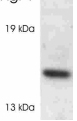 Anti-Cyclophilin F antibody (ab3567) at 1 µg/ml + Rat heart lysateObserved band size : 15 kDa (why is the actual band size different from the predicted?)Anti-rabbit HRP (ab6721)