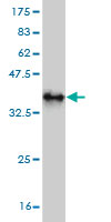 Western blot against tagged recombinant protein immunogen using ab58057 CYLN2 antibody at 1ug/ml.