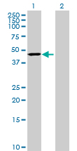 All lanes : Anti-CYP20A1 antibody (ab69189) at 1/500 dilutionLane 1 : CYP20A1 transfected 293T cell lysateLane 2 : Non transfected 293T cell lysateLysates/proteins at 25 µg per lane.SecondaryGoat Anti-Mouse IgG (H&L)-HRP Conjugate at 1/2500 dilution