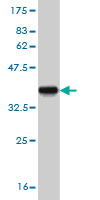 Western blot against tagged recombinant protein immunogen using ab54594 CYP24A1 antibody at 1ug/ml.