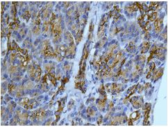 Immunohistochemical analysis of paraffin embedded Human pancreas tissue labeling CYP26A1 with ab172474 at 1/250 dilution.