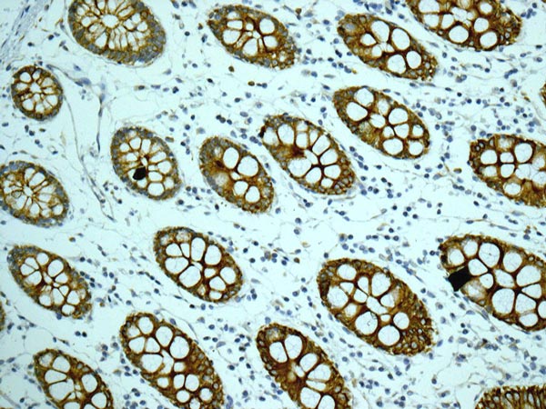 ab172474 showing +ve staining in Human normal colon tissue.
