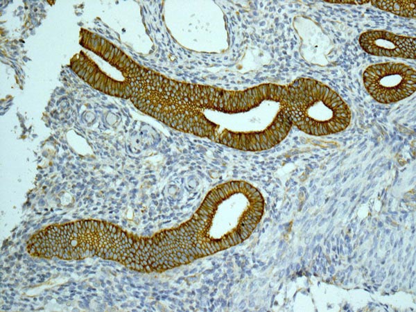 ab172474 showing +ve staining in Human normal uterus tissue.