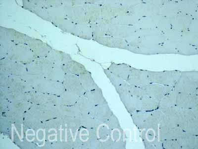 ab172474 showing -ve staining in Human skeletal muscle tissue.