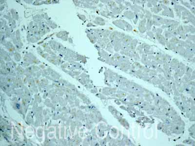 ab172474 showing -ve staining in Human heart muscle tissue.