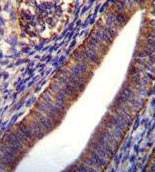 Immunohistochemistry (Formalin/PFA-fixed paraffin-embedded sections) analysis of human uterus tissue labeling COL21A1 with ab170780. A peroxidase-conjugated anti-rabbit IgG was used as the secondary antibody, followed by DAB staining.