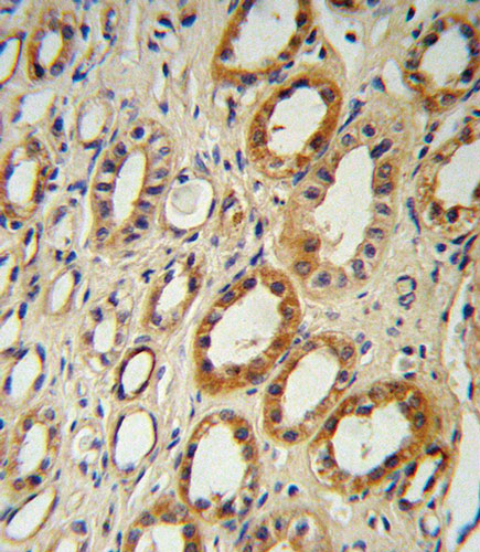 Immunohistochemistry (Formalin/PFA-fixed paraffin-embedded sections) analysis of human kidney tissue labelling CYP27B1 with ab95047. Tissue was fixed with formaldehyde and blocked with 3% BSA for 0.5 hour at 38°C; antigen retrieval was by heat mediation with a citrate buffer (pH6). Samples were incubated with primary antibody (1/25) for 1 hour at 37°C. A peroxidase-conjugated goat anti-rabbit polyclonal (ready to use) was used as the secondary antibody.