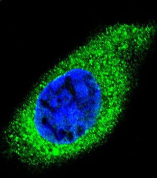 Immunocytochemistry/immunofluorescence analysis of HepG2 cells labeling COL21A1 (green) with ab170780. An Alexa Fluor® 488-conjugated goat anti-rabbit lgG was used as the secondary antibody. DAPI was used to stain the cell nuclei (blue).