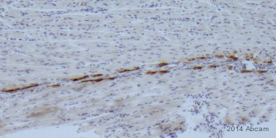 ab121846 staining COL22A1 in mouse muscle tendon junction (knee muscle) tissue sections by Immunohistochemistry (IHC-P - paraformaldehyde-fixed, paraffin-embedded sections). Tissue was fixed with formaldehyde and permeabilized with 0.2% Triton X-100 in PBS; antigen retrieval was by heat mediation in Tris pH 9.0. Samples were incubated with primary antibody (1/100 in PBS) for 16 hours at 4°C. An undiluted biotin-conjugated anti-rabbit IgG polyclonal was used as the secondary antibody.See Abreview