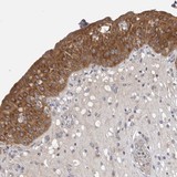 ab121846 at 1/250 dilution staining COL22A1 in Paraffin-embedded Human urinary bladder tissue by Immunohistochemistry. Note: strong cytoplasmic positivity in urothelial cells.