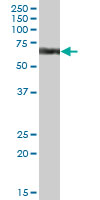 Anti-CYP4V2 antibody (ab69392) at 1/500 dilution + human liver lysate at 50 µgSecondaryGoat Anti-Mouse IgG (H&L)-HRP Conjugate at 1/2500 dilution