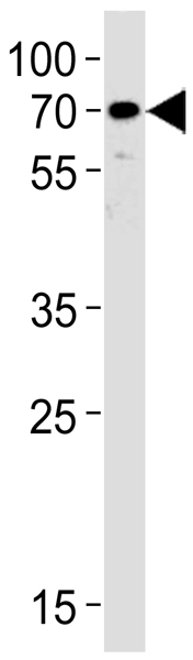 Anti-CYP51A1 antibody (ab135723) at 1/1000 dilution + LNCap cell lysate at 35 µgSecondaryHRP-conjugated goat anti-rabbit IgG (H+L) at 1/5000 dilution