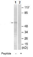 All lanes : Anti-CYP7B1 antibody (ab74858) at 1/500 dilutionLane 1 : extracts from LOVO cellsLane 2 : extracts from LOVO cells with immunizing peptide at 10 µgLysates/proteins at 30 µg per lane.