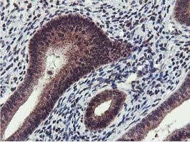 ab119803 at 1/150 dilution staining Cystatin SA in Paraffin-embedded Human Endometrium tissue by Immunohistochemistry.