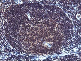 ab119803 at 1/150 dilution staining Cystatin SA in Paraffin-embedded Human Tonsil tissue by Immunohistochemistry.