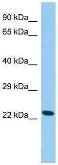 Anti-Cysteine Dioxygenase Type 1 antibody (ab150705) at 1 µg/ml + Rat testis lysate at 10 µg
