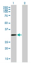 All lanes : Anti-Cysteine Dioxygenase Type 1 antibody (ab167328) at 1 µg/mlLane 1 : Cysteine Dioxygenase Type 1 transfected 293T cell lyateLane 2 : non transfected 293T cell lysateLysates/proteins at 15 µl per lane.SecondaryGoat Anti-Mouse IgG HRP at 1/2500 dilution